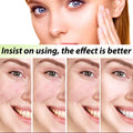 Crème Anti-Acné Purifiante – Soin Anti-Imperfections