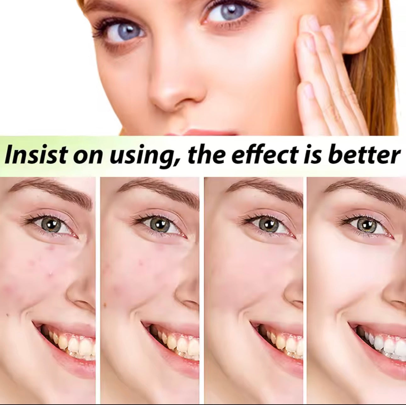 Crème Anti-Acné Purifiante – Soin Anti-Imperfections